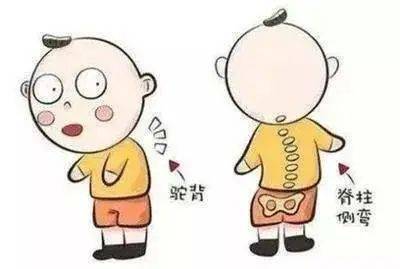 特色诊疗# 驼背的小朋友越来越多,家长怎么处理?